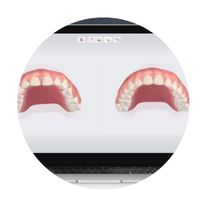 3Shape Orthodontic Simulation