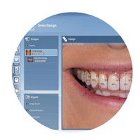3Shape Smile Designing Software